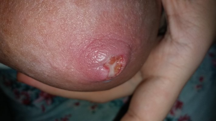 Mr97Ku8rsIsraoY2g6wwKEwZI8MbeSZy_med